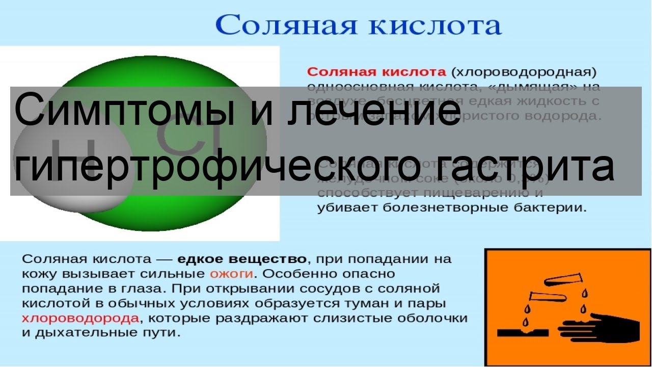 Симптомы и лечение гипертрофического гастрита - YouTube