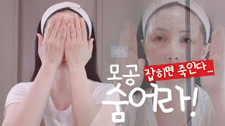 열받는다! 열받아!! 모공 문 닫아!!