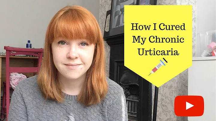 How I cured my Chronic Urticaria - DayDayNews