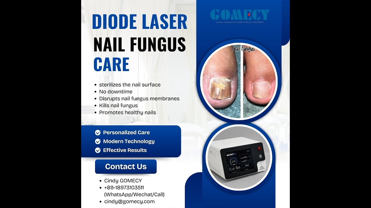 diode laser testing