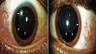 Uncovering the Secret World of Invisible Disabilities: Part 1