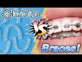 Braces Vs. Invisalign [What's Best For You?] | Premier Orthodontics