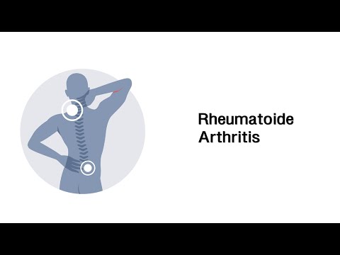 Rheumatoide Arthritis - Rheumatische Erkrankungen