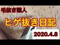毛抜職人ヒゲ抜き日記　2020.4.8 コロナ収束まで毎日更新します。鼻下の続きを抜きます
