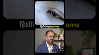 AC चा दुष्परिणाम आपल्या डोळ्यांवर होऊ शकतो का? #dryeyes #svac #acsideeffects
