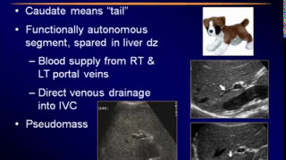 Sonography of the Liver screenshot 3