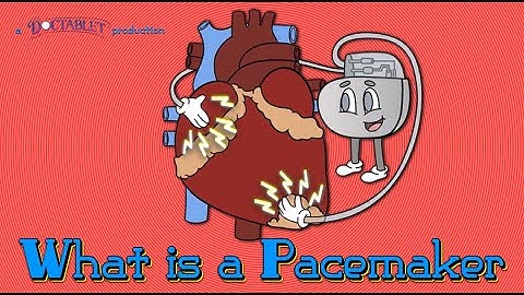 What is a Pacemaker? Lead-less pacemakers, Cardiac Resynchronization