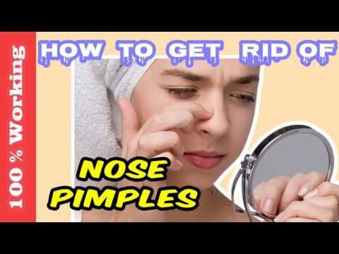 How To Get Rid Of Pimples On Nose Overnight - Fast - Home Remedies - Blackheads - Acne - Remove