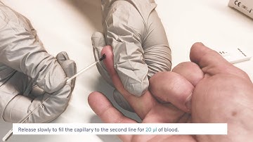 How to perform the Acro 2019 nCoV IgG/IgM Rapid Test (capillary version)