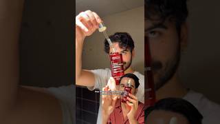 Saç Dökülme Problemi Yaşıyorsanız Bu Öneri Tam Size Göre Çdökülmesi