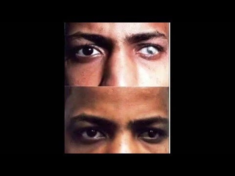 برنامج مع د هيام عادل استشارى جراحات تجميل العين عن تاتو سحابة القرنية البيضاءوتكنيك حديث