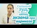 Сильный зуд на ноге, красные пятна, экзема при варикозном расширении вен