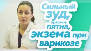 видео Розовый лишай Жибера: возбудитель, инкубационный период, пути передачи, осложнения