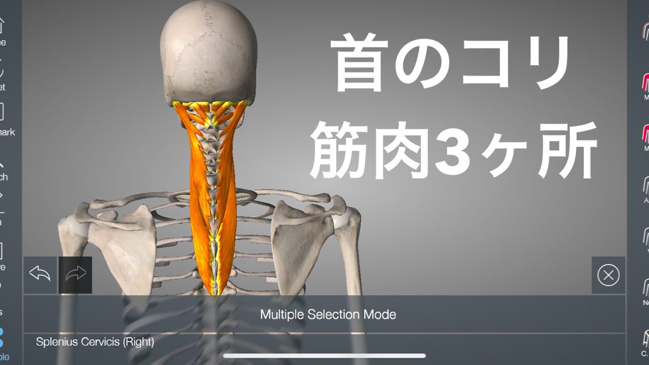 首のコリの原因になる筋肉を3カ所解説してみた