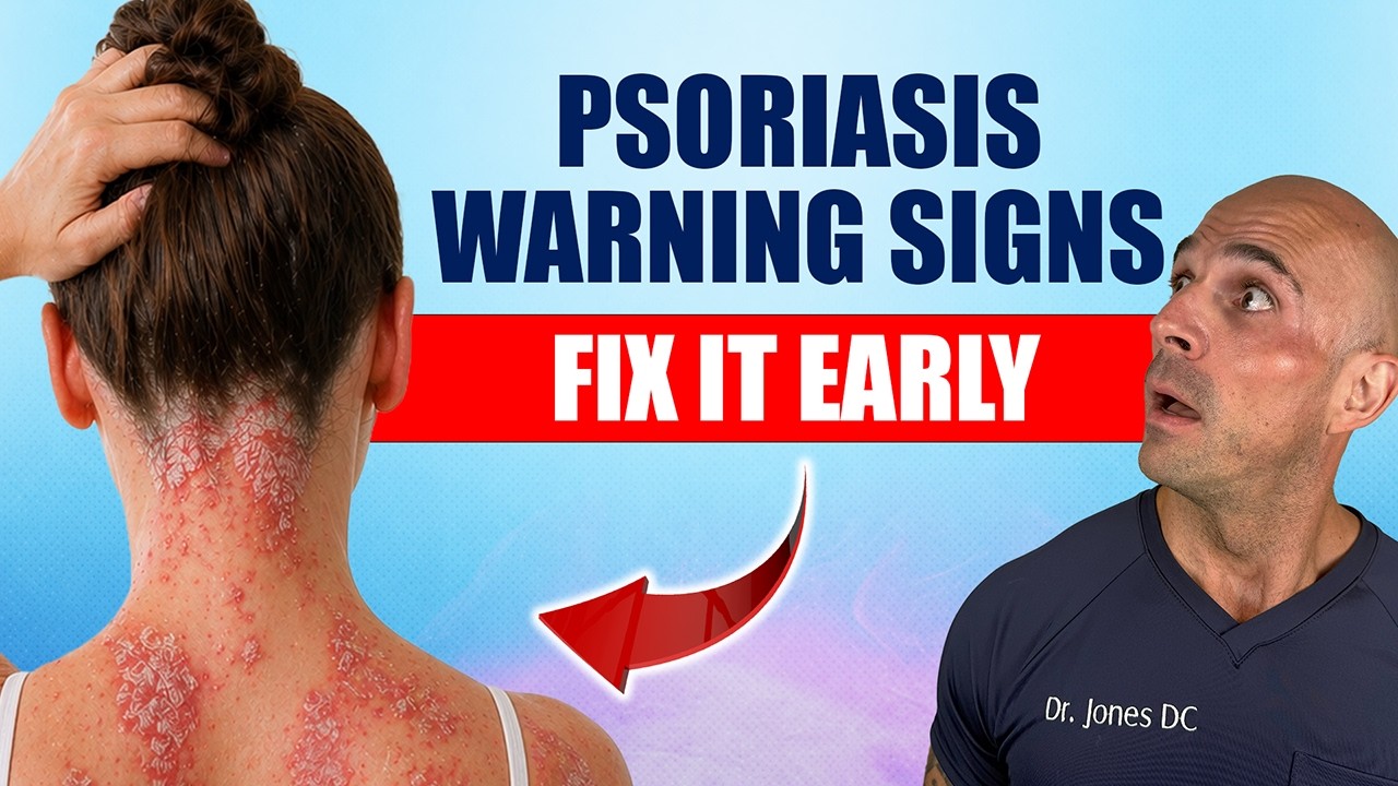 DOCTOR EXPLAINS WARNING SIGNS OF PSORIASIS & HOW TO FIX IT FAST