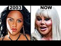 The Toxic Culture of Plastic Surgery in Hip Hop