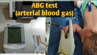 ABG test in Hindi.abg test kya hota hai.arterial blood gas analysis.how to do abg test?
