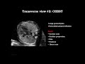 Cardiac Imaging in Early Gestation:  From Basic to Advanced