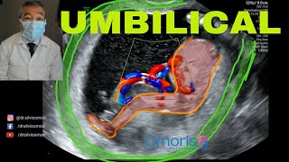 Kordonu Geni̇talya Kariştirir Mi? - 14 Hafta