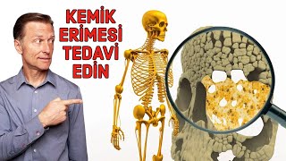 Kemik Erimesi (Osteoporoz) Kalsiyum Eksikliği Değildir – Osteoporoz Tedavileri | Dr.Berg Türkçe Resimi