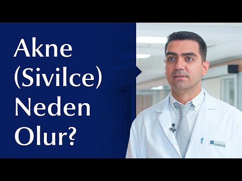 Akne (Sivilce) Nedir? Tedavi Yöntemleri Nelerdir?