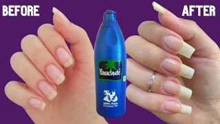 How to Whiten & Grow Your Nails Naturally At Home | 5 Home Remedies | how to grow nails fast screenshot 5
