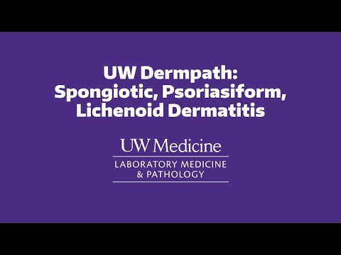 UW Dermpath: Spongiotic, Psoriasiform, Lichenoid Dermatitis