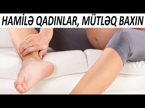 Video: Hamiləlik Zamanı şişkinliyi Necə Təyin Etmək Olar