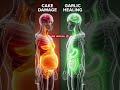 Healing with Garlic: A Digestive Revelation