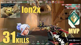 Ion2x ON JETT Drops 31 KILLS & Match MVP! 🔥 | VALORANT Gameplay