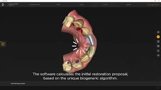 Primemill with inLab Software chairside workflow: creating an anterior crown