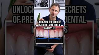 ✨ Unlocking the Secrets of Predictable Dental Makeovers ✨