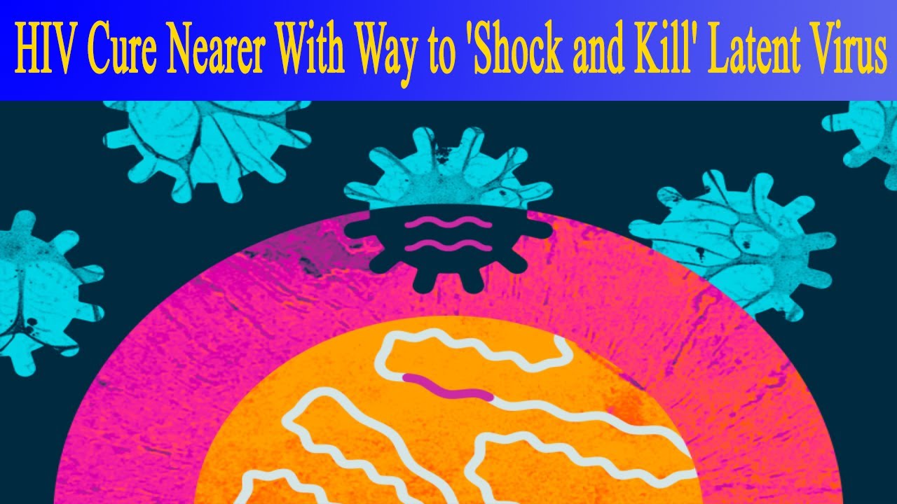 HIV Cure Nearer With Way to 'Shock and Kill' Latent Virus - YouTube