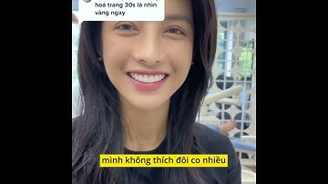 CHỤP RĂNG SỨ / BỌC RĂNG SỨ / LÀM RĂNG SỨ cho diễn viên Trình Mỹ Duyên trước khi bấm máy phim mới