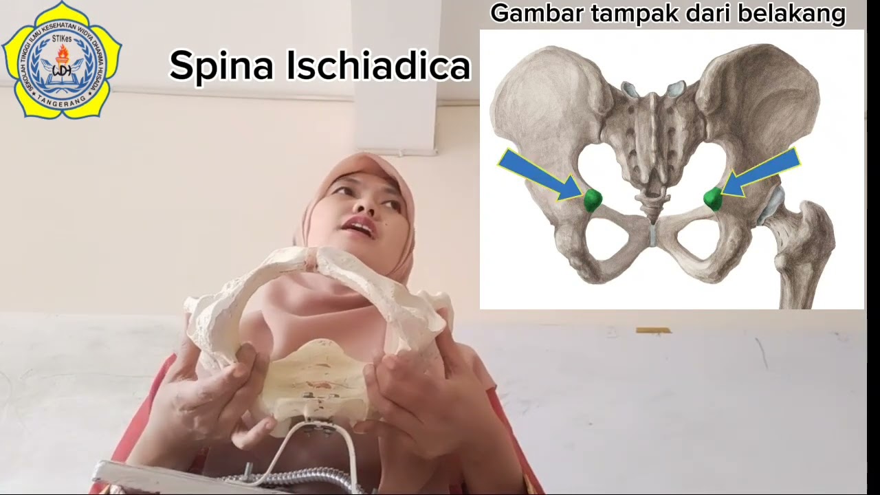 ANATOMI PANGGUL (PELVIS)