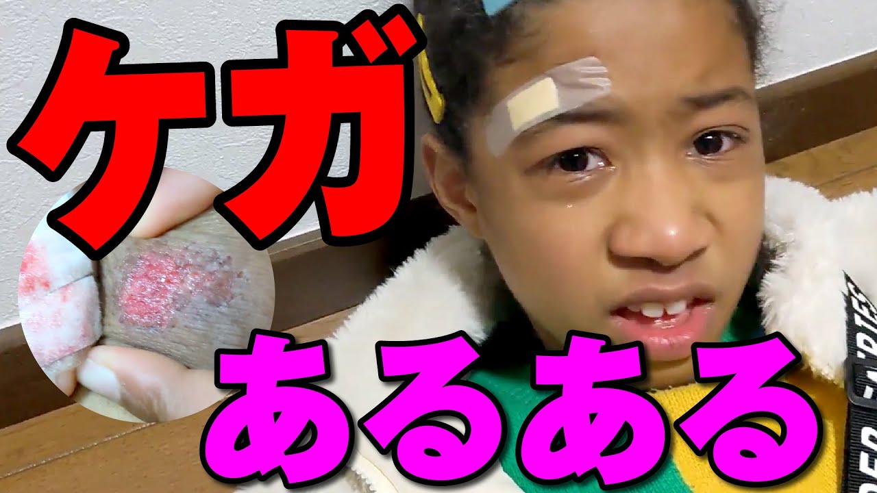 【ケガあるある】またもミーミ大けが…涙に絶叫に…もうてんやわんや