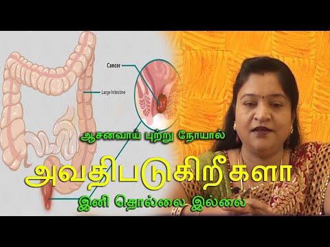 ஆசன வாய் புற்றுநோய் || Anal Mouth Cancer || Beauty & Healthy Tamil Tips