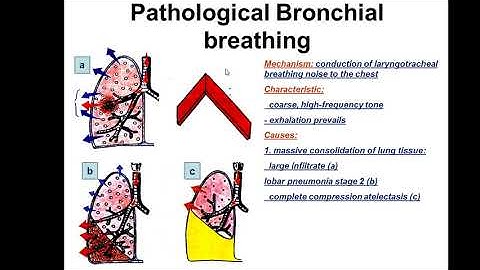 While auscultating a clients lungs, the nurse notes the presence of adventitious sounds