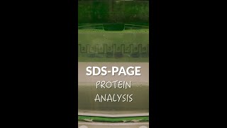 Protein Ysis Through Sds-Page
