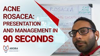 Acne Rosacea: Presentation and Management in 90 seconds
