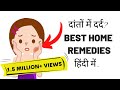 Best Home Remedies For Toothache | दांतो के दर्द से पायें आराम