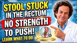 Stool STUCK in the Rectum! What is it and what to do – Doctor Reveals!