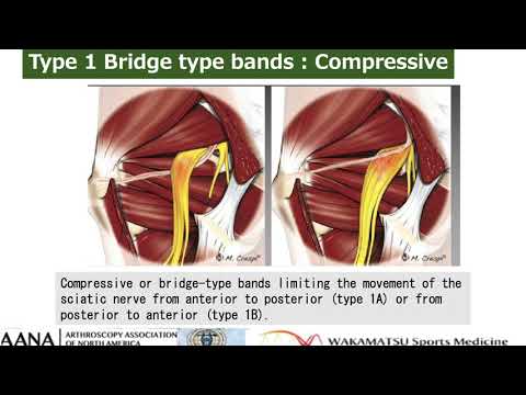 SU lecture   Deep gluteal syndrome   in AANA course