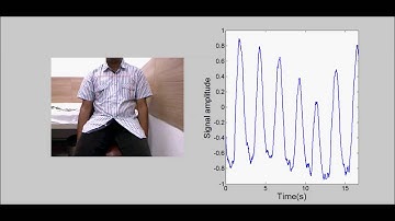 Respiration monitoring using webcam