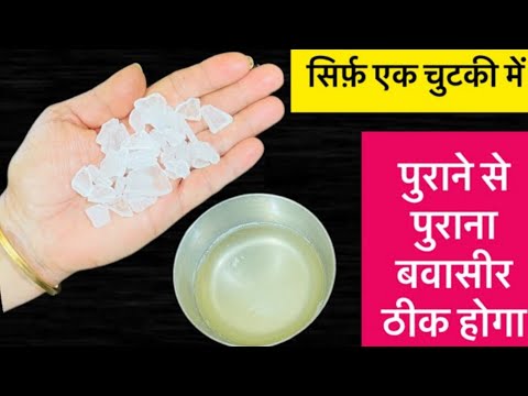 बवासीर के मस्सों का घरेलू उपाय / Bawaseer Ka desi ilaj