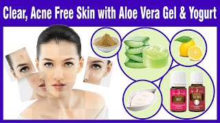 Get Clear, AcneFree Skin with Aloe Vera Gel & Yogurt Face Mask