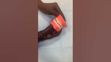 What if I break or lose my Invisalign trays?