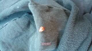 Ladybug on sweatshirt flies at person