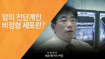 암의 전단계인 비정형 세포란? - (20121013_431회 방송)_내 몸에 혹이 자란다, 양성종양