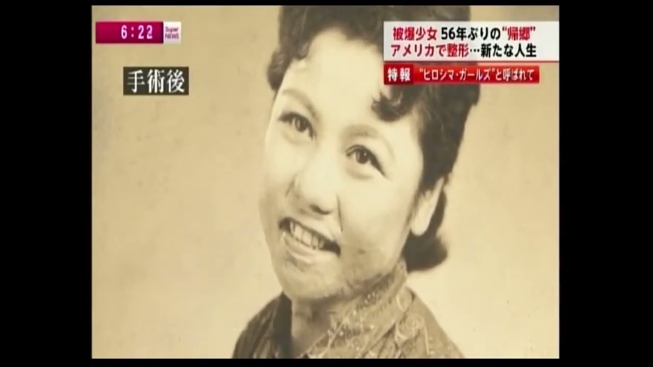 The Life of Shigeko, Once Known as a “Hiroshima Maidens”